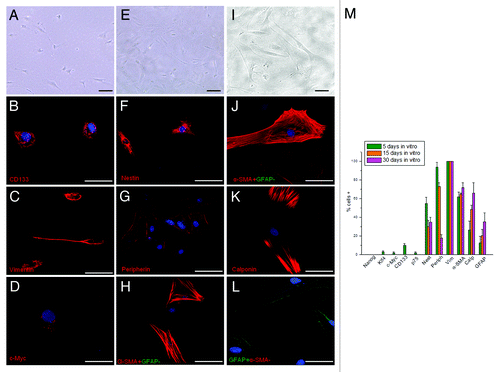 Figure 7. Morphological and immunocytochemical profile of the tumor during a long-term aerobic incubation. (A) Phase-contrast image of AH130 cell population after 5 d in aerobic culture. Bar = 50 µm. (B‒D) Representative signature of ascites cells after 5 d in aerobic culture. Bar = 50 µm. (E) Phase-contrast image of AH130 cell population after 15 d in aerobic culture. Bar = 50 µm. (F‒H) Representative signature of ascites cells after 15 d in aerobic culture. Bar = 50 µm. (I) Phase-contrast image of AH130 cell population after 30 d in aerobic culture. Bar = 50 µm. (J‒L) Representative signature of ascites cells after 30 d in aerobic culture. Bar = 50 µm. (M) Summary of AH130 cells’ immunocytochemical profiles during a long-term aerobic incubation. Values are expressed as mean ± SEM of three experiments.