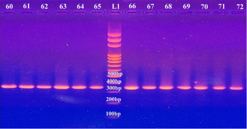 Figure 1 PCR products of amplified blaOXA-51used in molecular confirmation of A. baumannii. L1; 100 bp DNA ladder supplied from Solis BioDyne, Estonia; lanes 60–65 and 66–72 represent the isolate number .