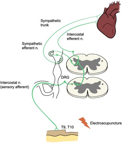 Figure 6 Nociceptor-inducing conditioning (NIC).