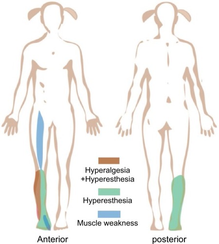 Figure 1 Images illustrating the subregion of hyperalgesia, hyperesthesia, and muscle weakness.