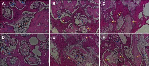 Figure 9 HE staining of n-CDHA/MAC composite scaffolds (A, B and C) and 1% Cu-doped n-CDHA/MAC composite scaffolds (D, E and F) harvested at postoperative 4, 8, and 12 weeks (magnification 40×). (A and D), 4 weeks; (B and E), 8 weeks; (C and F), 12 weeks. The red arrow represents inflammatory cells. The blue arrow represents blood vessel. And yellow arrow represents bone matrix in macropores.Abbreviations: HE, hematoxylin and eosin; n-CDHA/MAC, nano calcium-defcient hydroxyapatite/multi(amino acid) copolymer.