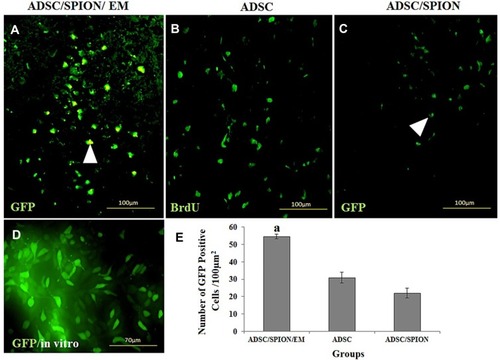 Figure 6 The histological section of the brain in the substantia nigra pars compacta. (A and C) show the morphology of transfected ADSC/SPION with GFP (A): ADSC/SPION/EM and (C) ADSC/SPION). (B) shows the ADSC labeled by BrdU, and (D) shows ADSC label by SPION and GFP transfection in an in vitro system for the evaluation of efficiently labeling cells. (E) shows the histogram of the cell viability after transplantation. aStatistically different from ADSC and ADSC/SPION. 