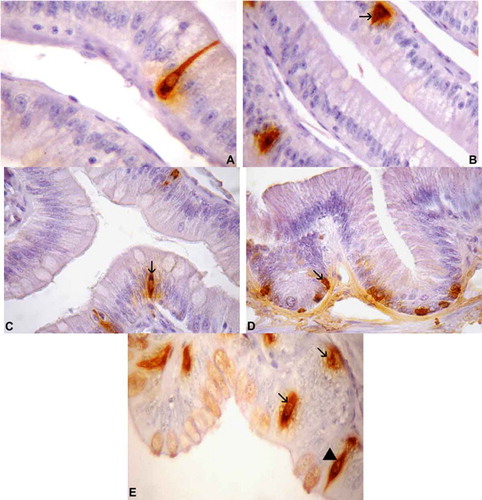 Figure 4. Photomicrographs of serotonin-immunoreactive (IR) cells in the intestine of Tropidurus torquatus. (A–C) Small intestine. A, Highlighting the cytoplasmatic process of serotonin-IR cells of the open type (1040×). B, The presence of serotonin-IR cells at the base of the epithelium, some of the open type (arrow) and others of the closed type, can be observed (1000×). C, Serotonin-IR cells between the cells of the intestinal epithelium, all of the closed type (arrow; 870×). (D and E) Large intestine. D, Serotonin-IR cells at the base of the gland, all of the closed type (arrow; 870×). E, Closed-type cells at the base of the gland and epithelium (arrows) and open-type cells (arrowhead) between the cells of the intestinal epithelium (1040x×.