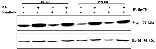 Figure 7. Regulation of Slp-76 tyrosine phosphorylation in HL-60 wt and Lyn KD cells by RA and Bosutinib. HL-60 wt and Lyn KD cells were untreated Controls or treated with 1 µM RA, or 0.25 µM Bosutinib or 1 µM RA and 0.25 µM Bosutinib as indicated. Cells were cultured for 72 h. Slp-76 was immunoprecipitated and immunoprecipitates were probed with anti-p-tyr for tyrosine phosphorylation by Western blotting (upper). Presence of Slp-76 bait in immunoprecipitate was confirmed (lower). All blots shown are representative of three biological replicates, and the trend for changes in signal intensity levels are consistent among the repeats