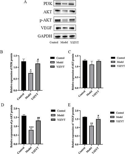 Figure 8 Protein expression patterns of rats in control, model, and YJZYT groups. (A) Western blot analysis. (B–E) Protein expression of PI3K, AKT, p-AKT and VEGF using GAPDH as an internal reference. Data are presented as mean ± SEM; *Compared to the Control group, *P < 0.05, **P < 0.01, ***P < 0.001. #Compared to the Model group, #P < 0.05, ##P < 0.01.