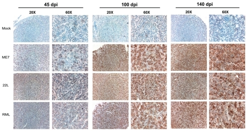 Figure 3 Growth hormone (Gh) antibody staining in the anterior pituitary gland (adenohypophysis) from scrapie- and mock-infected mice at 45, 100, and 140 days post-infection. Images show sections stained with Gh antibodies (brown) and counterstained with haematoxylin (blue). Images were collected with 20 × and 60 × objectives as indicated. Note increased Gh immunoreactivity in glandular cells of anterior pituitary in sections from scrapie-infected mice relative to mock-infected mice.