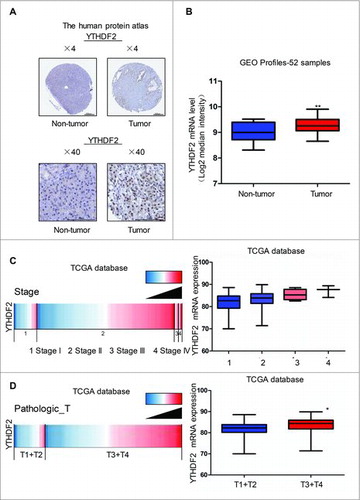 Figure 1. YTHDF2 is up-regulated in pancreatic cancer and associated with patients' poor stage. (A) YTHDF2 protein expression in pancreatic cancer tissues and normal pancreatic tissues was analyzed through the human protein atlas (www.proteinatlas.org). Magnification, × 4; bars, 500 μm. Magnification, × 40; bars, 100 μm. (B) Analysis of YTHDF2 mRNA levels in 52 samples of pancreatic cancer and non-tumor tissues in the Gene Expression Omnibus. N = 16 for non-tumor group, and N = 36 for tumor group. **P < 0.01. (C) Analysis of the TCGA database indicates YTHDF2 is associated with stage in pancreatic cancer. N = 20 for stage I group, N = 140 for stage II group, and N = 4 for stage III group, and N = 3 for stage IV group. *P< 0.05. (D) Analysis of the TCGA database indicates YTHDF2 is associated with PathologicT in pancreatic cancer. N = 27 for PathologicT1 and T2, N = 140 for PathologicT3 and T4. *P < 0.05.