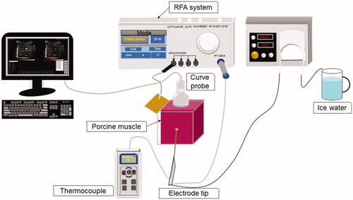 Figure 1. The experimental setup comprised an ultrasound imaging system, a clinical RFA system equipped with a cool-tip needle electrode, a radiofrequency generator, a peristaltic pump, cables, and accessories. In vitro experiments were performed to validate the proposed method.