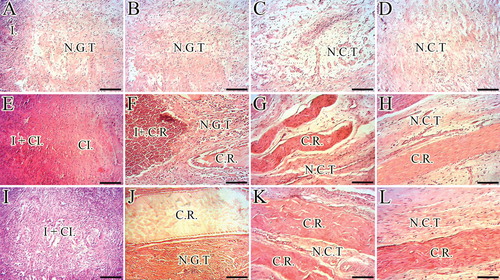 Figure 10. Histopathologic features of the healing injured tendons at 10 – 40 days post-injury (DPI). A to D are ICTs, E to H are ITTCs, I to L are ITTC-Ps. A, E and I = 10 DPI; B, F and J = 15 DPI; C, G and K = 30 DPI; D, H, L = 40 DPI. Compared to the ICTs, implantation of the CI significantly increased migration and proliferation of the inflammatory cells in the injured area at 10 DPI (E). At 15 DPI (F), the inflammatory cells lysed some parts of the CI but these cells were still accumulated in some part of the CI. At 30 DPI, most parts of the CI degraded but few remnants incorporated with the newly developed connective tissue (N.C.T.). At 40 DPI, the preserved parts have been accepted as a part of tendon but the new tissue covering these remnants was still immature in nature (H). Compared to the ITTCs, treatment with platelets, considerably, improved the inflammatory cells infiltration so that the cells were well infiltrated all over the scaffold at 10 DPI (I), following no inflammatory cells accumulation at 15 DPI (J) so that the collagen remnants were free of inflammation. At 30 DPI, the collagen remnants (C.R.) were well accepted as parts of new tendon and a well-vascularized newly developed connective tissue regenerated between these remnants (K). At 40 DPI, the new connective tissue covering the accepted parts of the scaffold was considerably more mature than those seen in the ITTCs (H). Compared to the ICTs, the implants increased the inflammatory response at earlier stages of tendon healing which promoted a stronger fibrous response in the treated lesions. Scale bar A to D, E, I and J = 50 µm; F, G, H and L = 25 µm. Color staining = H&E.