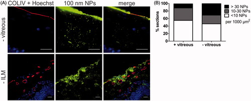 Figure 7. (A) Representative cryosection images showing the transport of 100 nm sized PS beads into the retina, 24 h after applying the beads on the explants. Top row: no vitreous, bottom row: no ILM. ILM and blood vessels (red) are stained by anti-COLIV antibodies, nuclei (blue) with Hoechst, particles are shown in green. Scale bar: 20 µm. (B) Semi-quantitative analysis of 100 nm PS bead uptake in vitreoretinal explants compared to conventional explants without vitreous (n = 3).