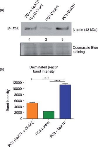 Fig. 5.  MV stimulation of PC3 cells leads to increased β-actin deimination that is reduced upon PAD inhibition. PC3 cells were stimulated with BzATP to microvesiculate and total deiminated proteins immunoprecipitated using the F95 pan-deimination protein antibody. (a) Increased deiminated β-actin was observed in PC3 cells stimulated to microvesiculate with BzATP (Lane 3) compared to untreated, control PC3 cells (Lane 2). Upon treatment with 10 µM of the pan-PAD-inhibitor Cl-am prior to MV stimulation, a significant decrease was observed in the levels of deiminated β-actin (Lane 1). Equal amounts of protein extract immunoprecipitated with F95 were loaded as shown by Coomassie blue staining. (b) A bar chart representing deiminated β-actin band intensity as measured by protein densitometry and normalised intensity (calculated in Image J) from each of the treatments immunoblotted in (a).