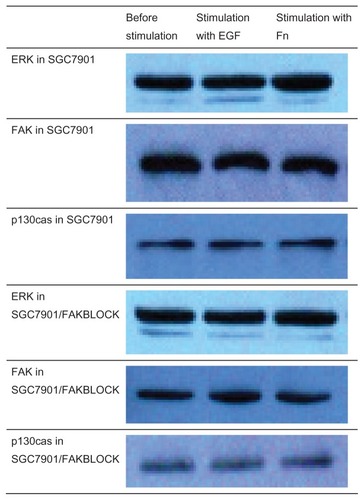 Figure 1 Expression of ERK, FAK, and p130cas with stimulation of EGF or Fn.