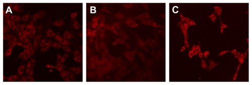 Figure 11 LSCM images showing rhodamine B-labeled formulations (A) microemulsion; (B) tincture; and (C) aqueous suspension.Abbreviation: LCSM, laser scanning confocal microscopy.