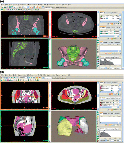 Figure 1. Screen captures of the Mimics software showing the interfaces for reconstructing 3D models of the the structures of interest. (A) Bony structures reconstructed from CT images. (B) Non-bony structures reconstructed from MRI images.