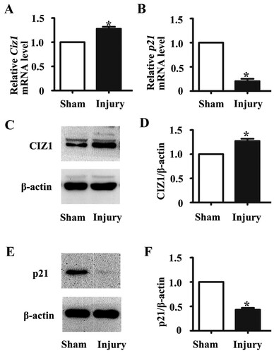 Figure 2. CIZ1 expression was up-regulated, and p21 expression was down-regulated in mouse arteries after injury with neointimal hyperplasia. The mRNA levels of Ciz1 (a) and p21 (b) in sham and injured arteries as determined by RT-PCR. n = 3, *, P < .05. Western blot analysis determines CIZ1 (c) and p21 (e) protein levels in sham and injured arteries. β-actin was used as an internal control. Densitometric analysis of the blots of CIZ1 (d) and p21 (f). n = 3, *, P < .05.