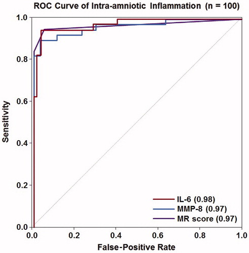 Figure 1. Receiver operating characteristic curve analysis for the use of IL-6, MMP-8 and the Mass Restricted (MR) score for the detection of intra-amniotic inflammation. The AUCs for using IL-6 or MMP-8 were not statistically significantly different from that of the MR score (each p ≥ 0.7).