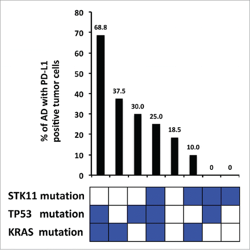 Figure 4. Percentage of PD-L1 expression in adenocarcinomas and mutational status of significantly associated genes. The combination of TP53 mutation, KRAS mutation and STK11 wildtype is associated with the highest percentage of PD-L1 expression in adenocarcinoma tumor cells. Conversely, STK11 mutations in the absence of TP53 and KRAS mutations are associated with the lowest percentage.