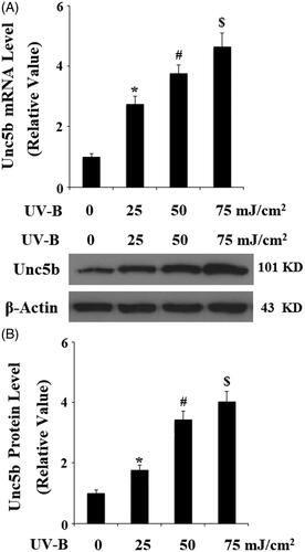 Figure 2. Expression of UNC5b is increased in response to exposure to ultraviolet-B (UV-B) in ESCs. ESCs were exposed to UV-B at the intensity of 25–75 mJ/cm2 for 8 h. (A) Expression of UNC5b at the gene level was determined by real-time PCR analysis; (B) Expression of UNC5b at the protein level was determined by western blot analysis (ANOVA:*, #, $, p < .001 vs previous column group, n = 4–5).