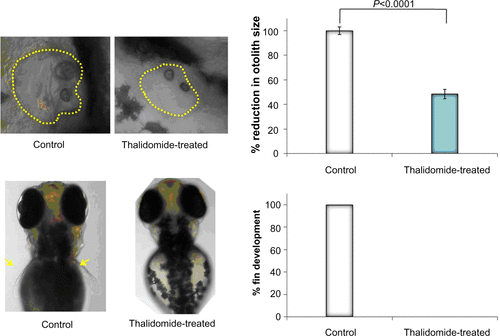 Figure S3 Gross morphological changes in the zebrafish larvae following treatment with thalidomide.Notes: Thalidomide treatment exhibited 52% reduction in otolith size and 100% absence of fin development. Yellow arrows indicate the fin development and yellow dotted circles indicate otolith boundary.