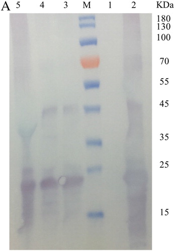 Figure 7. Western blotting results of the 5B protein that was confirmed by anti-His antibodies. Note. Lane M: Protein ladder; Lane 1: Negative control without IPTG; Lane 2: Inclusion body; Lane 3: Puriﬁed protein with 100 mM imidazole buffer; Lane 4: Puriﬁed protein with 200 mM imidazole buffer; Lane 5: Puriﬁed protein with 300 mM imidazole buffer.