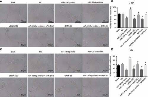 Figure 6. Angiogenesis evaluation depicts the upregulation of miR-129-5p resulting in the inhibition of CC cell angiogenesis ability in vitro.Note: A, angiogenesis images of C-33A cell line in the eight groups (scale bar = 50 μm); B, the number of blood vessels in C-33A cell line; C, angiogenesis images of Hela cell line in the six groups (scale bar = 50 μm); B, the number of blood vessels in Hela cell line; NC, negative control; miR-129-5p, microRNA-129-5p; ZIC2, zinc finger protein of the cerebellum 2; *, p < 0.05 compared with the blank and NC groups; #, p < 0.05 compared with the miR-129-5p inhibitor group.