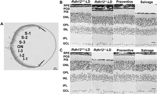 Figure 4 Histological differences after gene therapy in four groups. (A) HE staining of mouse retina in the low magnification micrograph. (B) (3 months)/ (C) (6 months): HE staining in S-2 of four groups. Scale bar, 20 µm.