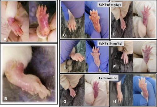 Figure 12 (A and B) Ventral and dorsal view of Grade-4 arthritic paw of mice at day-0 of treatment. (C) Ventral and dorsal view of Grade-4 arthritic mice treated with SeNP (5 mg/kg) at day-7 while (D) representing the paw at day-14 of the treatment showing significant recovery of normal paw size, (E) ventral and dorsal view of arthritic mice treated with SeNP (10 mg/kg) at day-7 while (F) representing the paw at day-14 of the treatment, (G) ventral and dorsal view of arthritic mice treated with Leflunomide (10 mg/kg) at day-7 and (H) representing the paw at day-14 of the treatment showing reduction in the paw size along with the recovery of ankylosis.