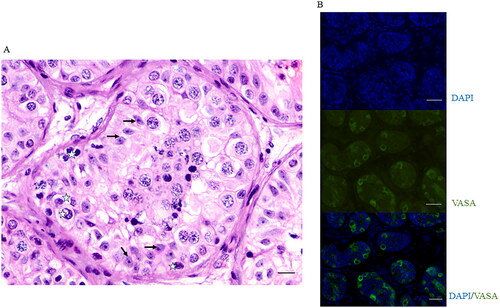 Figure 1. Representative images of histology (A) and immunofluorescence with DDX4/VASA (B) used for spermatogonial and Sertoli cell quantification. White stars and black arrows in figure A depict spermatogonia and Sertoli cells, respectively. Scale bar in A represents 100 µm; in B represents 50 µm.