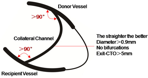 Figure 4 The principle of collateral circulation selection.