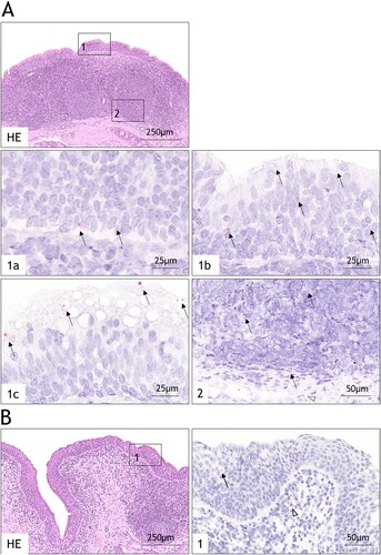 Figure 4. Histopathological findings using RNA in situ hybridization for tissues of carrier animal 758 infected with wildtype FMDV strain O/FRA/1/2001. HE stains are shown for morphological orientation in the tissues only. Consecutive sections were used for the in situ hybridization. (A) HE-stained overview of the dorsal soft palate (DSP) showing the approximate location of positive FMDV NSP 3D-specific RNA signals in the ciliated pseudostratified columnar epithelium (box 1) and submucosal lymphoid tissue (box 2). On consecutive sections, arrows indicate viral RNA within basal cells (1a), within columnar cells (1b), on the apical surface of columnar cells (1c) and within submucosal lymphoid follicles (2), stained by in situ hybridization. (B) Overview of the dorsal nasopharynx (DNP) indicating the approximate location of positive RNA signals (box 1), HE stain. On consecutive sections, compared to the DSP, viral RNA was found in fewer cells in the epithelium (arrow) and submucosa (arrowhead) by in situ hybridization.