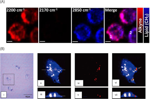 Figure 5 Cellular uptake analysis of the drug delivery systems based spontaneous bioorthogonal RS. (A) Raman images of live HeLa cells treated with PPE NPs (10 μg/mL) for 6 hours are presented. Scale bars indicate 5 μm. Reproduced from Li S, Chen T, Wang Y et al. Conjugated polymer with intrinsic alkyne units for synergistically enhanced Raman imaging in living cells. Angewandte Chemie International Edition. 2017;56(43):13455–13458. © 2017 Wiley-VCH Verlag GmbH & Co. KGaA, Weinheim.Citation73 (B) MCF-7 cells treated with DSPC-d70 liposomes (i). Raman images of one cell reconstructed from the C-H (ii) and C-D stretching intensities (iii). Overlay of Raman images related to both C-H and C-D stretching intensities (iv). A depth profile was collected for the same cell (v–vii). Reproduced from Matthäus C, Kale A, Chernenko T, Torchilin V, Diem M. New ways of imaging uptake and intracellular fate of liposomal drug carrier systems inside individual cells, based on Raman microscopy. Molecular Pharmaceutics. 2008;5(2):287–293. Copyright © 2008 American Chemical Society.Citation74