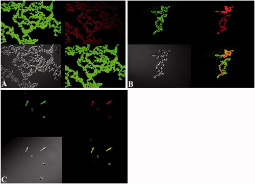 Figure 8. CSLM image C. albicans biofilm. A. Control. (B and C) treated with 0.125 and 0.25 mg/ml of ZnO NPs. Biofilms were stained with ConA-FITC and P I. ConA-FITC stained C. albicans cells as well as exopolysaccharide matrix green. PI stained nucleic acid and fluorescent red. Obvious increase in cell shape and size can be seen in images B and C.