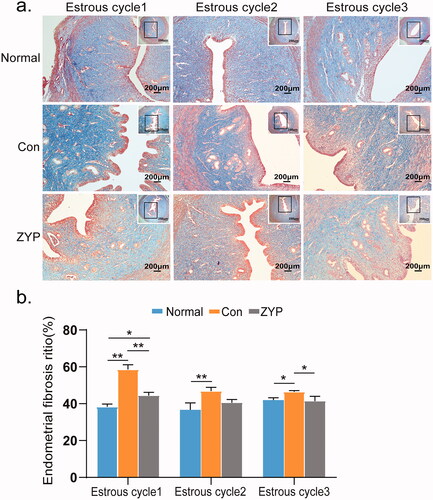 Figure 4. The fibrosis of rat endometrium in three groups. (*p < 0.05, **p < 0.01) (a) The fibrosis of the endometrium with Masson staining (×100). (b) Comparisons of endometrial fibrotic areas ratio: the fibrosis of endometrium in the normal group and the ZYP group was lower than that in the control group at all three time points after induced abortion (*p < 0.05; Figure 4(b)). Bar = 200 μm; Con: control; ZYP: Zishen Yutai Pill.