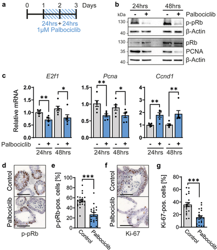 Figure 2. Palbociclib inhibits the cell cycle in intestinal organoids.