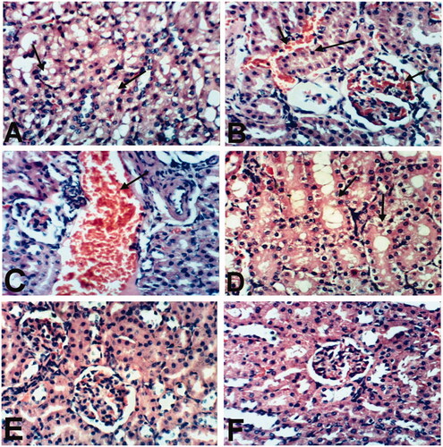 Figure 3. Kidney of rat treated with (A) indomethacin showing vacuolization of epithelial lining renal tubules (arrow). (B) Indomethacin showing congestion of intertubular blood vessels and glomerular tuft (small arrow) and pyknosis of the nuclei of renal tubular epithelium (large arrow). (C) BCO showing dilatation and congestion of renal blood vessel (arrow). (D) COO showing vacuolation of epithelial lining renal tubules (arrows). (E) CLO showing no histopathological changes. (F) Control showing the normal histological structure of renal parenchyma. (H & E x 400).