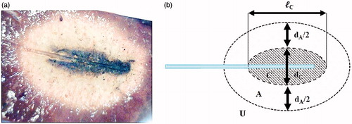 Figure 2. (a) Image of coagulated tissue obtained after ex vivo MWA, and (b) schematic representation of the appearance of the coagulated tissue.