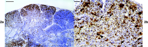 Figure 2. 2a: Low magnification of an infected thymus showing virus positive cells in both the cortex and medulla. Bar=100 μm. 2b: High magnification of the thymus showing nuclear labelling of lymphocytes (arrows), dense labelling in very enlarged cells (white arrowhead) and in an unidentified structure (see results) (black arrowhead). Bar=10 μm.