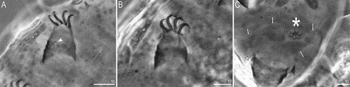 Figure 5. Bryodelphax beniowskii sp. nov.: A—claws on leg I; arrowhead indicates papilla (paratype), B—claws of leg III (paratype), C—gonopore surrounded by patches of granulation; arrowhead indicates papilla on leg IV, asterisk indicates gonopore, arrows indicate patches of granulation (holotype). Scale bars in [μm]. All PCM.