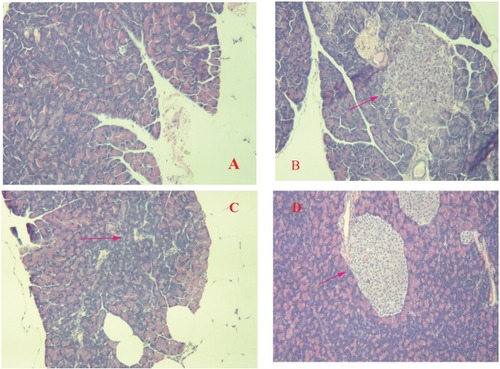 Figure 6 Histopathological changes in the pancreas of db/db mice. The diabetic control group showed evidence of severe damage characterized by a reduced number and area of islets, the transformation of borders, vacuolation, and the degranulation of cells (B), whereas the normal control group exhibited islets with typical histological structure in the pancreas (A). The administration of Met and DHM restored the damaged islets, obviously ameliorating their structure (C and D). Red arrow symbols mean pancreatic lesions.