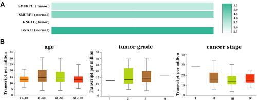 Figure 9 The mRNA expression of SMURF1 in ovarian serous cystadenocarcinoma. (A) mRNA expression comparison in ovarian cancer and normal tissues. (B) Association analysis on SMURF1 mRNA expression with clinical phenotypes of patients with ovarian serous cystadenocarcinoma.