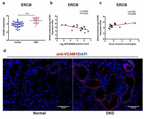 Figure 8. Verification, clinical relevance and immunofluorescence validation of VCAM1. (a) Verification of the increased VCAM1 expression in DKD in ERCB cohort (31 healthy controls and 17 DKD) (****P < 0.0001). (b) Correlation between VCAM1 expression and GFR in ERCB. (c) Correlation between VCAM1 expression and serum creatinine in ERCB. (d) Immunofluorescence staining of VCAM1 in normal kidney tissue and DKD. The tubular basements are outlined. Scale bars, 50 μm
