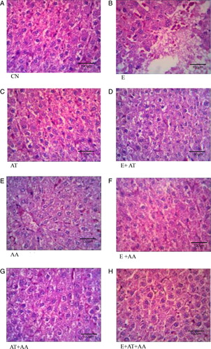 Figure 4. Histopathological analysis of liver (magnification 40×). (A) Control group showed normal liver architecture and cell structure. (B) Ethanol group showed extensive hepatocellular damage as evidenced by steatosis, vacuolization, and dilation of sinusoids. (C) AT group exhibited normal cell architecture as almost that of control. (D) E + AT group exhibited slight recovery from steatosis and inflammation. (E) AA group showed cells that were almost similar to the control. (F) E + AA group exhibited slight recovery from steatosis and inflammation. (G) AT + AA group showed cells almost similar to the control. (H) E + AT + AA group exhibited almost near normal cell architecture of CN group as evidenced by reduction in steatosis, vacuolization, dilation of sinusoids, and inflammation.