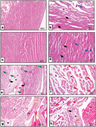 Figure 8. a&b: Photomicrographs of cardiac sections from corn oil fed rats showing slight separation (s), fibrosis of the myofibers (*), cardiomyocytes (black arrow), fibroblasts (blue arrow). c&d: cardiac sections from olive oil fed rats revealing branched myofibers, cardiomyocytes with centrally located oval nuclei (black arrow), fibroblasts lining the interstitial tissue (blue arrow). e&f: heart sections from rump fat fed rats depicting widely separated hyalinized myofibers(s), homogenous highly acidophilic sarcoplasm (green arrow), focal to multifocal necrosis (curved arrow), fibroplasia (*), pyknotic cardiomyocytes (red arrow). g&h: heart sections represent peri-kidney-fat fed rats showing disarrayed separated myofibers (s), pyknotic nuclei (red arrow), dilated congested blood vessels (yellow arrow), thick wall and extravasation (ex), inflammatory infiltration (orange arrows). (X100 in right panel, X400 in left panel, H&E).