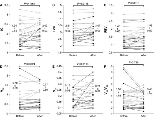 Figure 3 Pulmonary function tests pre- and post-treatment with indacaterol. The IC (A), FVC (B), FEV1 (C), V50 (D), V25 (E), and V50/V25 (F) pulmonary functions were compared pre- and post-treatment with indacaterol. FVC, FEV1, and V25 were significantly improved by treatment with indacaterol (P<0.05 for each).