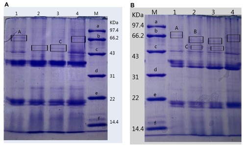 Figure 5 Analysis of OMPs of different P. aeruginosa strains. (A). 1, 4: PA1.2620; 2–3: PA-99. (B). 1, 4: PA27853; 2–3: PA-88.Abbreviation: M, standard protein marker.