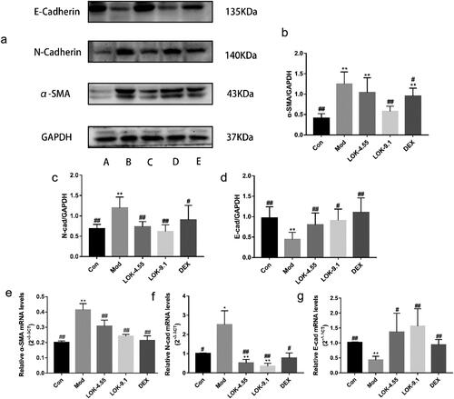 Figure 8. Lok decreased EMT in the lungs of mice with OVA-induced asthma. (a) The expressions of each protein were determined using Western blot. A (Con), B (Mod), C (Lok- 4.55), D (Lok- 9.1), E (Dex). Ratios of α-SMA (b), N-cadherin (c) and E-cadherin (d) intensity. The expressions of (e) α-SMA, (f) N-cadherin and (g) E-cadherin in mice lung tissues were detected by RT-qPCR. Data from six independent experiments. The obtained data are expressed as mean ± SD. n = 6, *p < 0.05, **p < 0.01, vs. con, #p < 0.05, ##p < 0.01, vs. Mod.