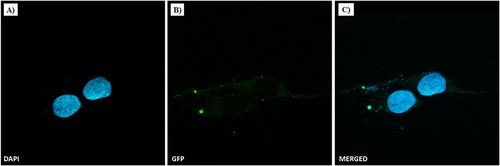 Figure 4 NF cellular uptake in MDA-MB-231 by confocal microscopy. TNBC cells were treated with NFs (2.5% of P6 peptide) at 50 µM for 1 h. Nuclei are shown in blue, stained with DAPI (A). NF is depicted in green (B). Merged images (C) derived from the overlapping of the two fluorescent emissions. Fluorescent microphotographs (63×oil immersion objective lens) are representative of three independent experiments.