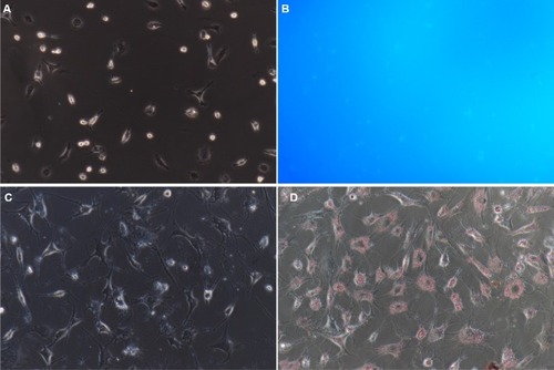 Figure 2 Identification of NPSCs by blue–green autofluorescence at 328 nm and oil red O staining.Notes: (A) NPSC autofluorescence bright field control (200×); (B) NPSC blue–green autofluorescence at 328 nm (200×); (C) NPSC oil red O staining bright field control (200×); (D) positive oil red staining of NPSCs (200×).Abbreviation: NPSC, normal pancreatic stellate cell.