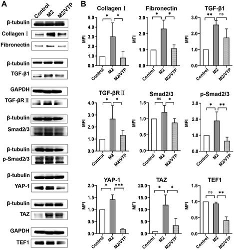 Figure 7. Crosstalk between YAP/TAZ and canonical TGFβ/Smad signalling contributed to M2 macrophage-induced fibrosis in HTFs. HTFs were treated with the fresh culture medium (control), M2-conditioned medium only and verteporfin (1.5 μmol/L, 3 h) followed by M2-conditioned medium treatment (M2/VTP) for 36 h. Protein levels of collagen I, fibronectin, YAP, TAZ and components of TGF-β1/smad signalling were determined by western blotting. (A) Representative images of western blot images. (B) Analysis of relative protein expression. GAPDH or β-tubulin was used as a loading control, as appropriate. *P < 0.05, **P < 0.01, ***P < 0.001; n = 3. All experiments were repeated three times independently. ns, not significant.