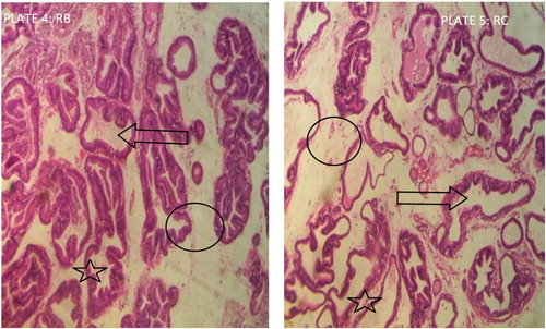 Plate 4-5. (HE-200X): Photomicrographs obtained from the histopathological examination of sections of prostate tissue from experimental groups RB and RC. Group RB: ARG+ MSG+ extract: 90:22.5:200 mg kg−1 b.wt and group RC: ARG+ MSG+ extract: 90:22.5 + 300 mg kg−1 b.wt. Key: [ð] indicate lumen [★] shows the gland unit while [○] shows the stroma and epithelial nuclei.